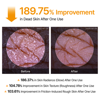 Peel Shot Kojic Acid Turmeric Duo