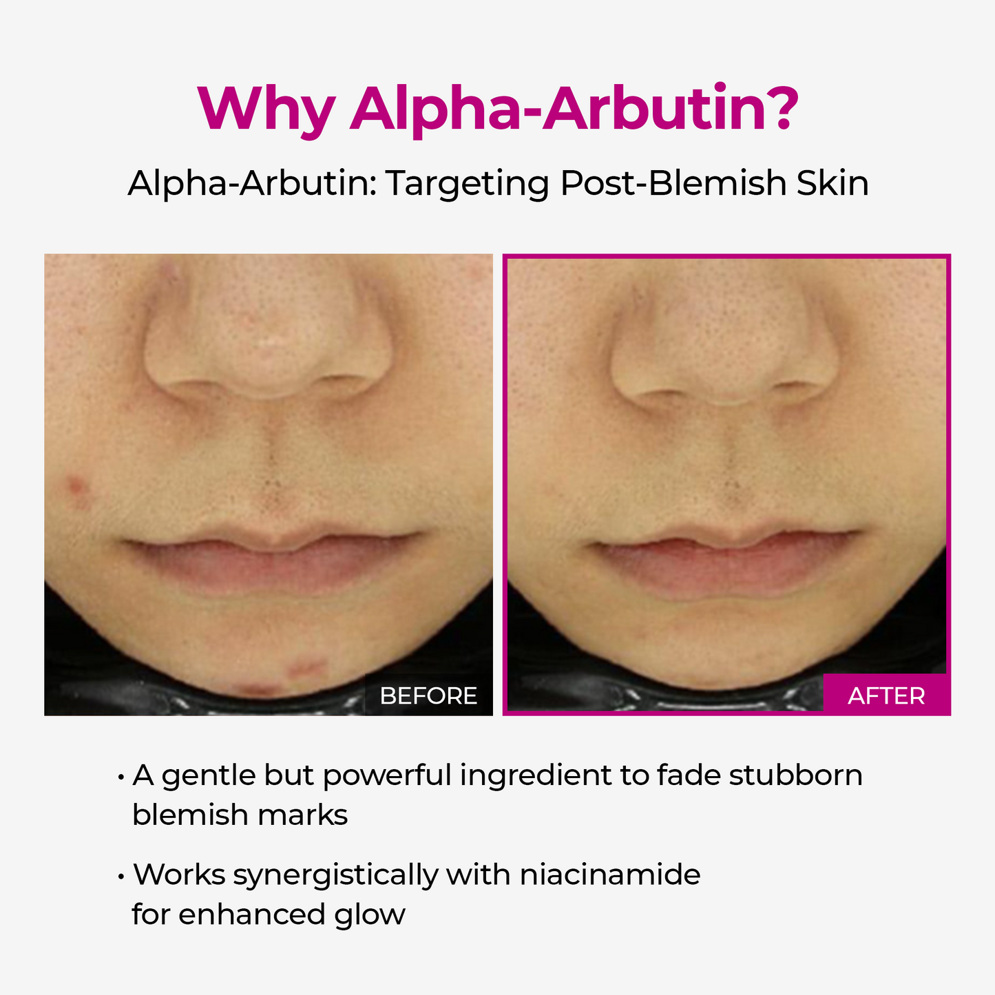 Lumi Pore & Spot Care Duo