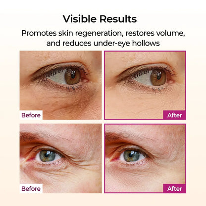 Cemenrete Calcium Eyecare Routine