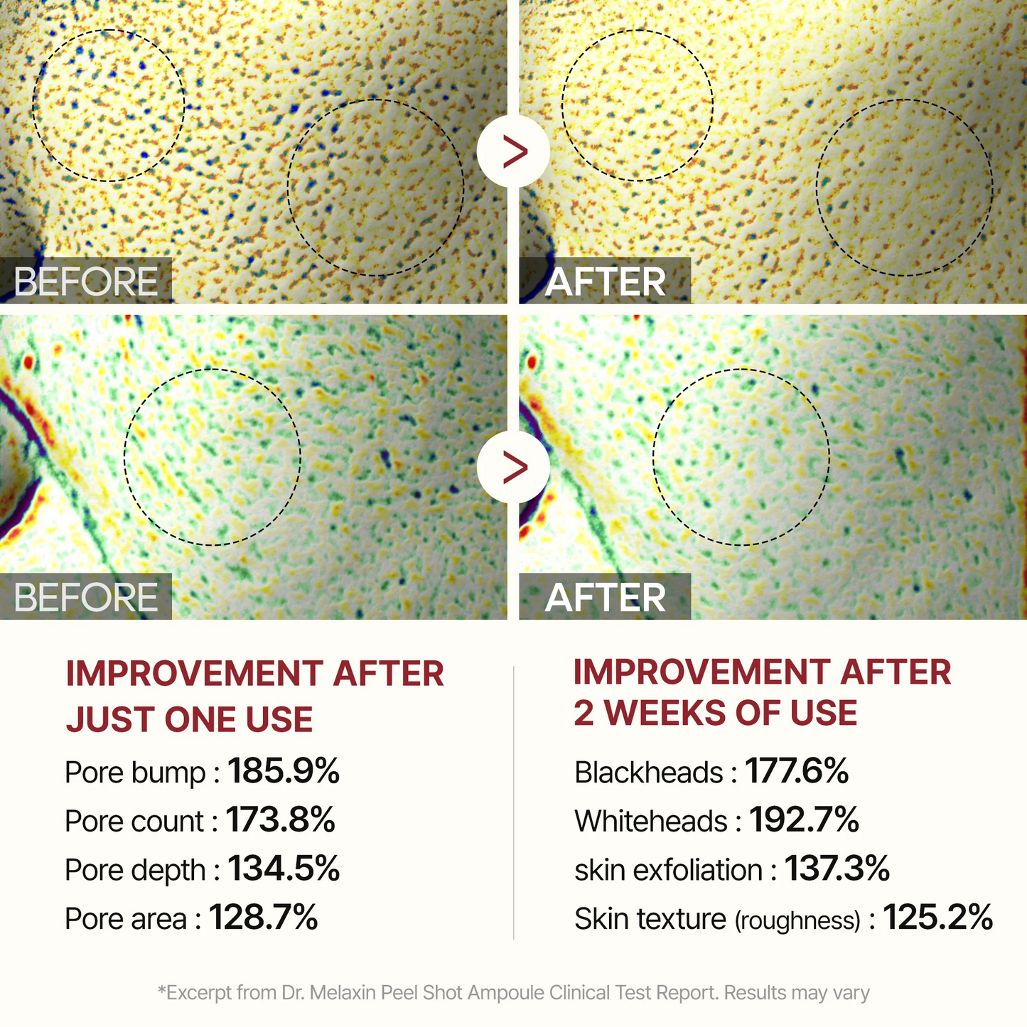 Dr. Melaxin Rice Peel Ampoule