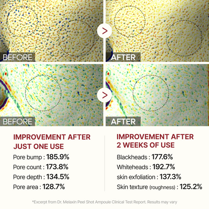 Dr. Melaxin Rice Peel Ampoule