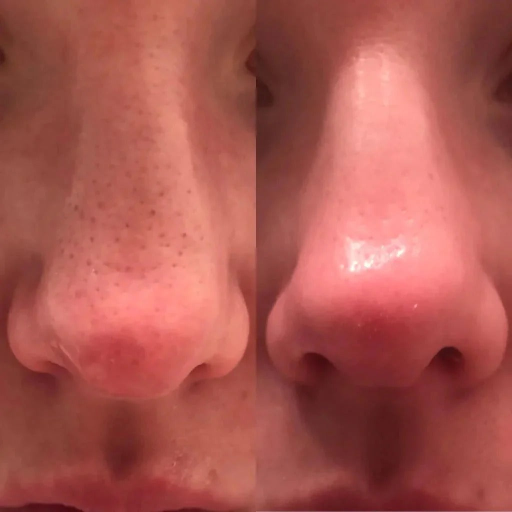 Dr. Melaxin Lumi Glow Prestige Bundle